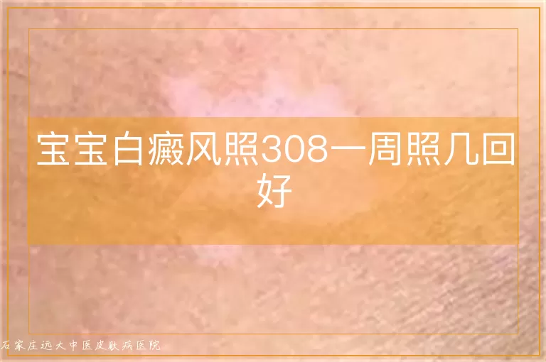 宝宝白癜风照308一周照几回好