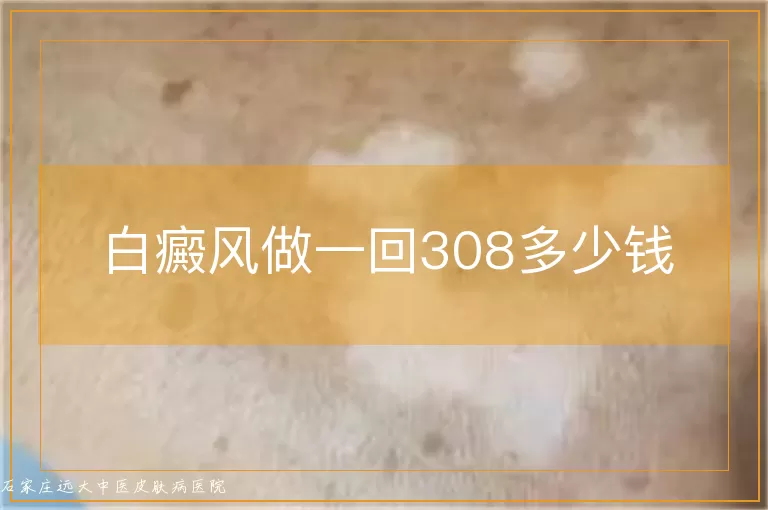 白癜风做一回308多少钱