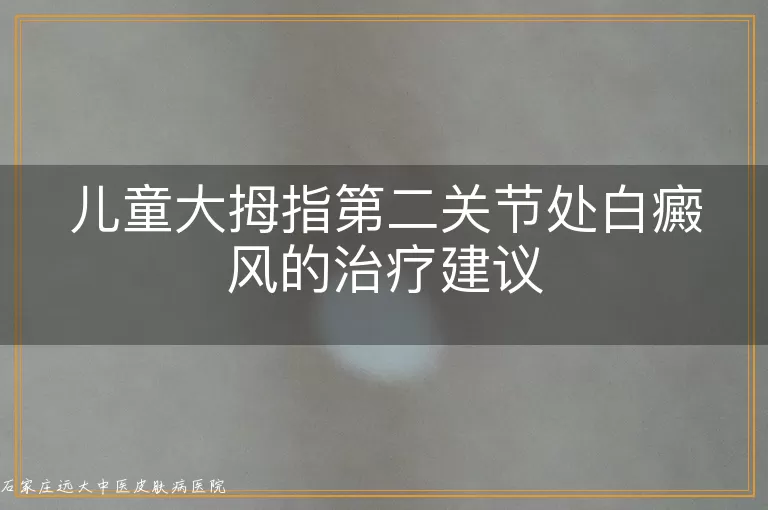 儿童大拇指第二关节处白癜风的治疗建议