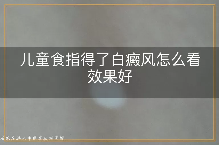 儿童食指得了白癜风怎么看效果好