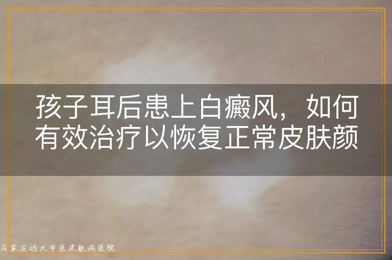 孩子耳后患上白癜风，如何有效治疗以恢复正常皮肤颜色