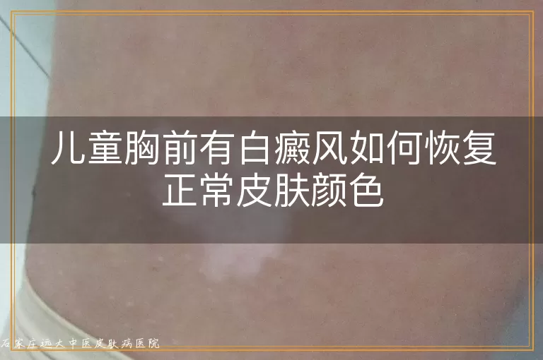 儿童胸前有白癜风如何恢复正常皮肤颜色