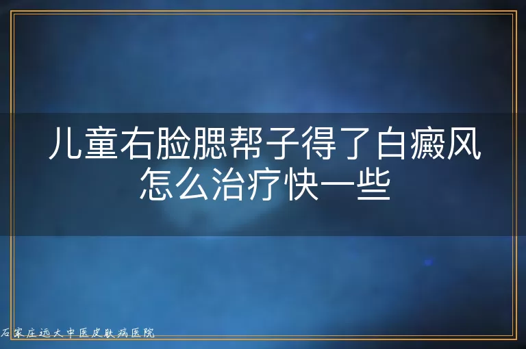 儿童右脸腮帮子得了白癜风怎么治疗快一些
