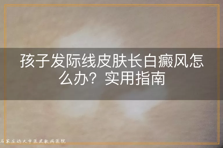 孩子发际线皮肤长白癜风怎么办？实用指南