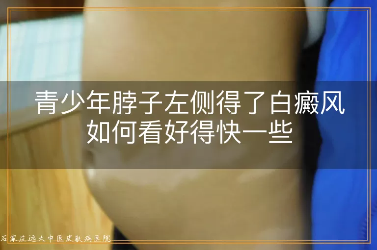 青少年脖子左侧得了白癜风如何看好得快一些