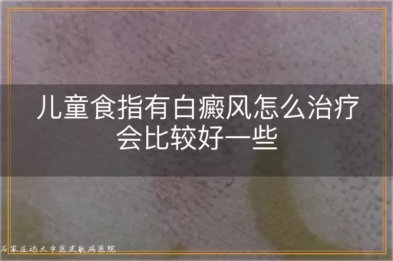 儿童食指有白癜风怎么治疗会比较好一些
