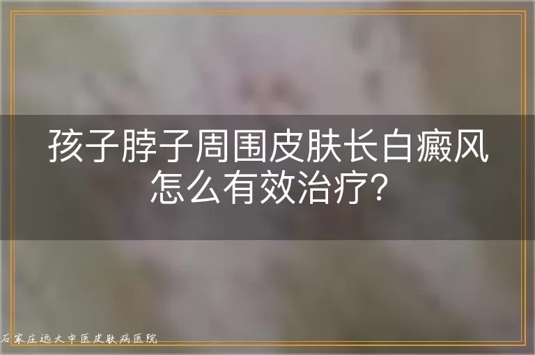孩子脖子周围皮肤长白癜风怎么有效治疗？