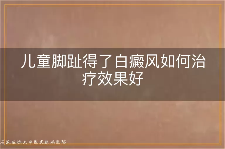儿童脚趾得了白癜风如何治疗效果好
