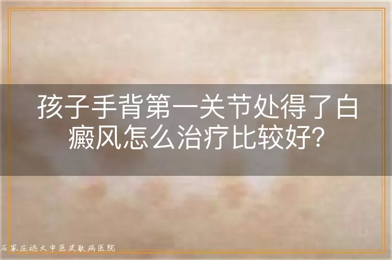 孩子手背第一关节处得了白癜风怎么治疗比较好？