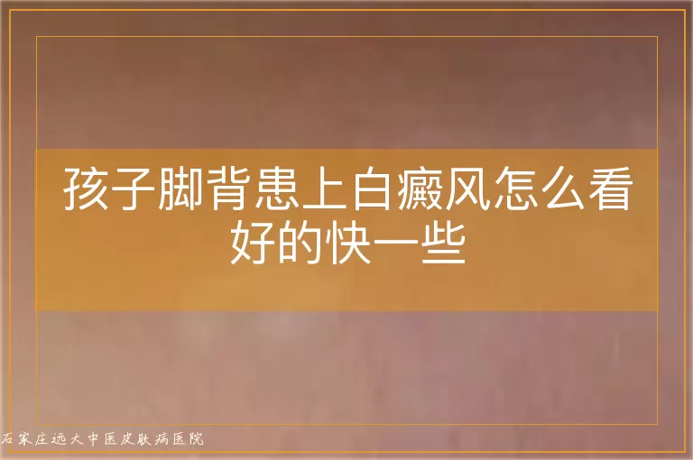 孩子脚背患上白癜风怎么看好的快一些