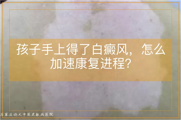 孩子手上得了白癜风，怎么加速康复进程？