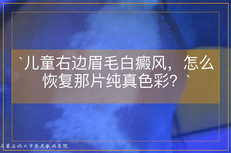 儿童右边眉毛白癜风，怎么恢复那片纯真色彩？