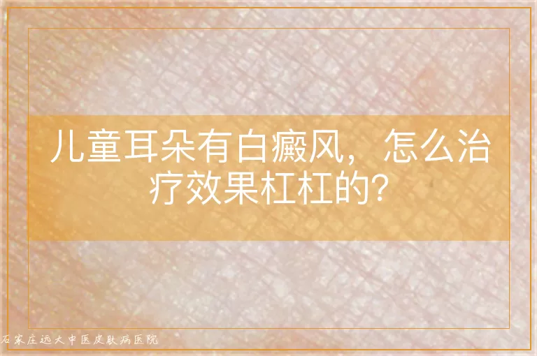 儿童耳朵有白癜风，怎么治疗效果杠杠的？