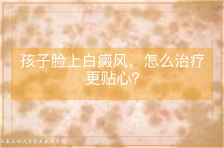 孩子脸上白癜风，怎么治疗更贴心？