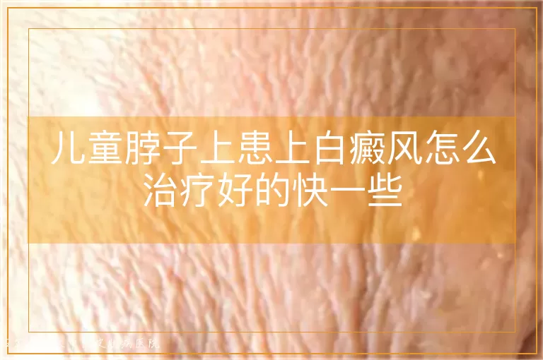 儿童脖子上患上白癜风怎么治疗好的快一些