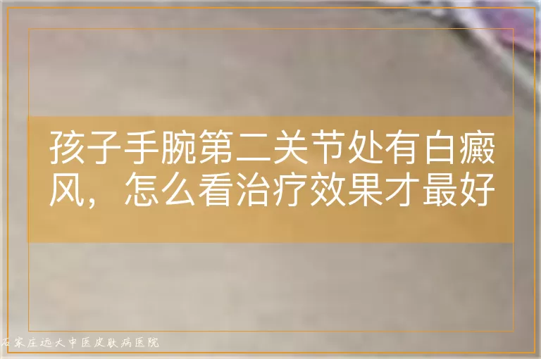 孩子手腕第二关节处有白癜风，怎么看治疗效果才最好？