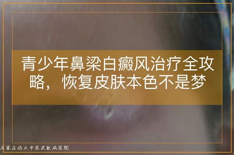 青少年鼻梁白癜风治疗全攻略，恢复皮肤本色不是梦