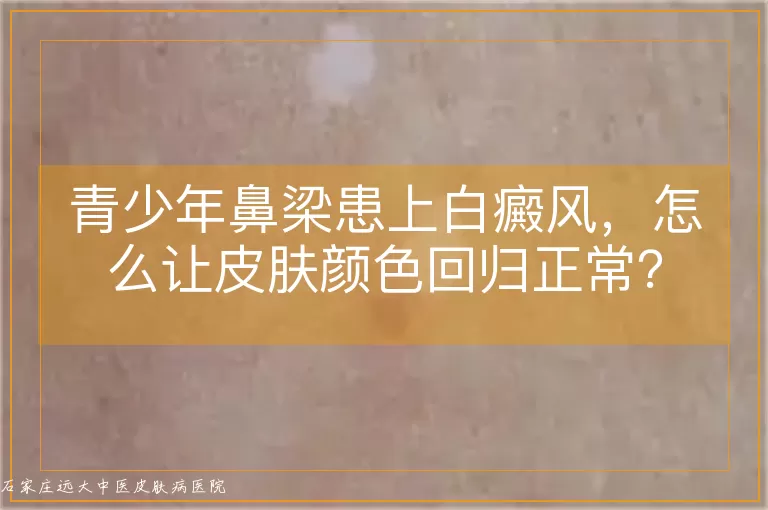 青少年鼻梁患上白癜风，怎么让皮肤颜色回归正常？