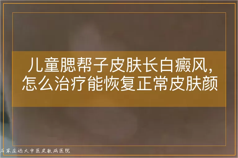 儿童腮帮子皮肤长白癜风，怎么治疗能恢复正常皮肤颜色？