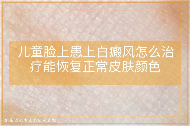 儿童脸上患上白癜风怎么治疗能恢复正常皮肤颜色