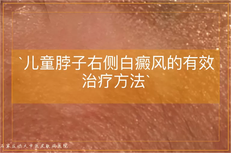 儿童脖子右侧白癜风的有效治疗方法