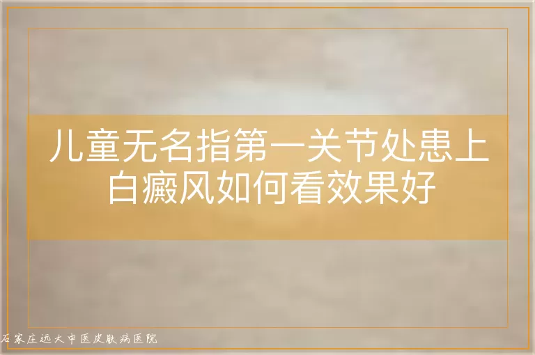 儿童无名指第一关节处患上白癜风如何看效果好