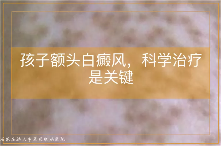 孩子额头白癜风，科学治疗是关键