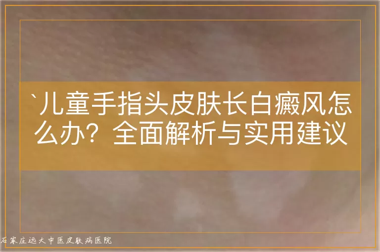 儿童手指头皮肤长白癜风怎么办？全面解析与实用建议