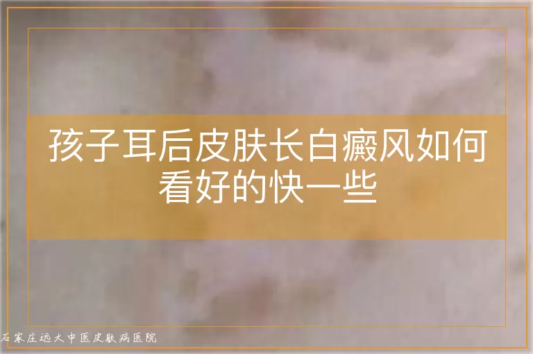 孩子耳后皮肤长白癜风如何看好的快一些