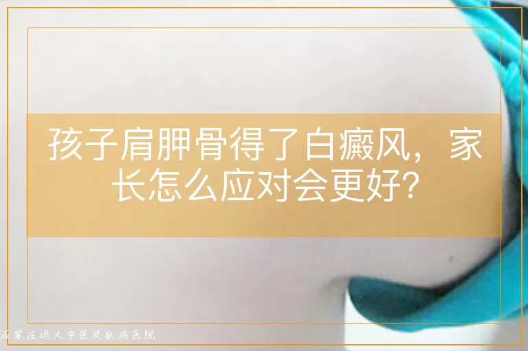 孩子肩胛骨得了白癜风，家长怎么应对会更好？