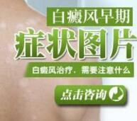 治疗顽固白癜风—中医拔火罐