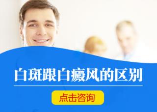 白癜风会不会痒