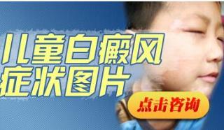 别因饮食不妥而形成白癜风减轻