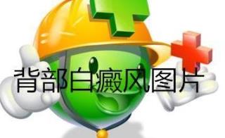白斑越来越大专家手把手辅佐你！