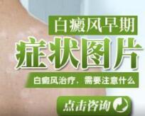 招致白癜风聚集的罕见缘由