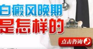 白癜风患者病发部位的特征