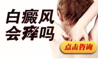 招致白癜风复发有哪些缘由