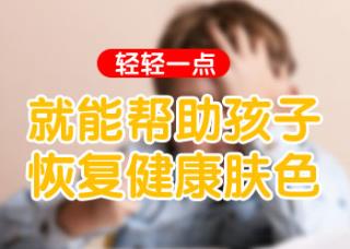 白癜风不治疗色彩会不会减退